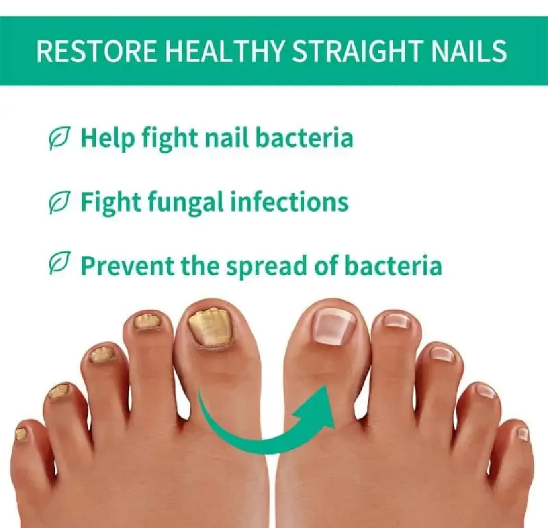 Nail Fungus Treatment -Advanced Antifungal Treatment