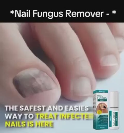 Nail Fungus Treatment -Advanced Antifungal Treatment